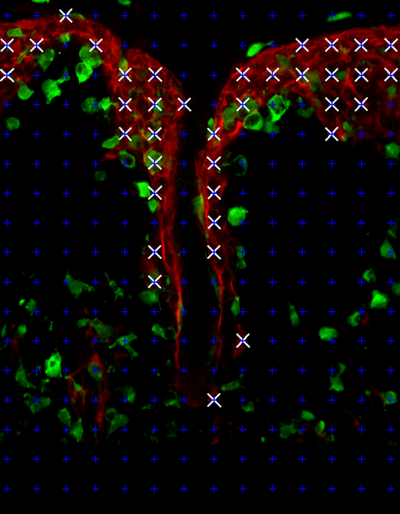 edited Red, Green, choroid plexus with probe and points, exported